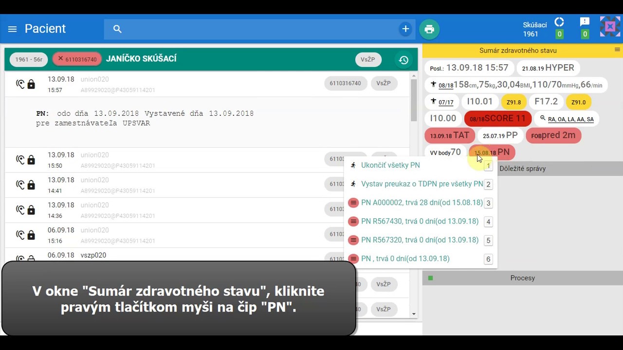 Náhľad videa Práca so sekciou PN