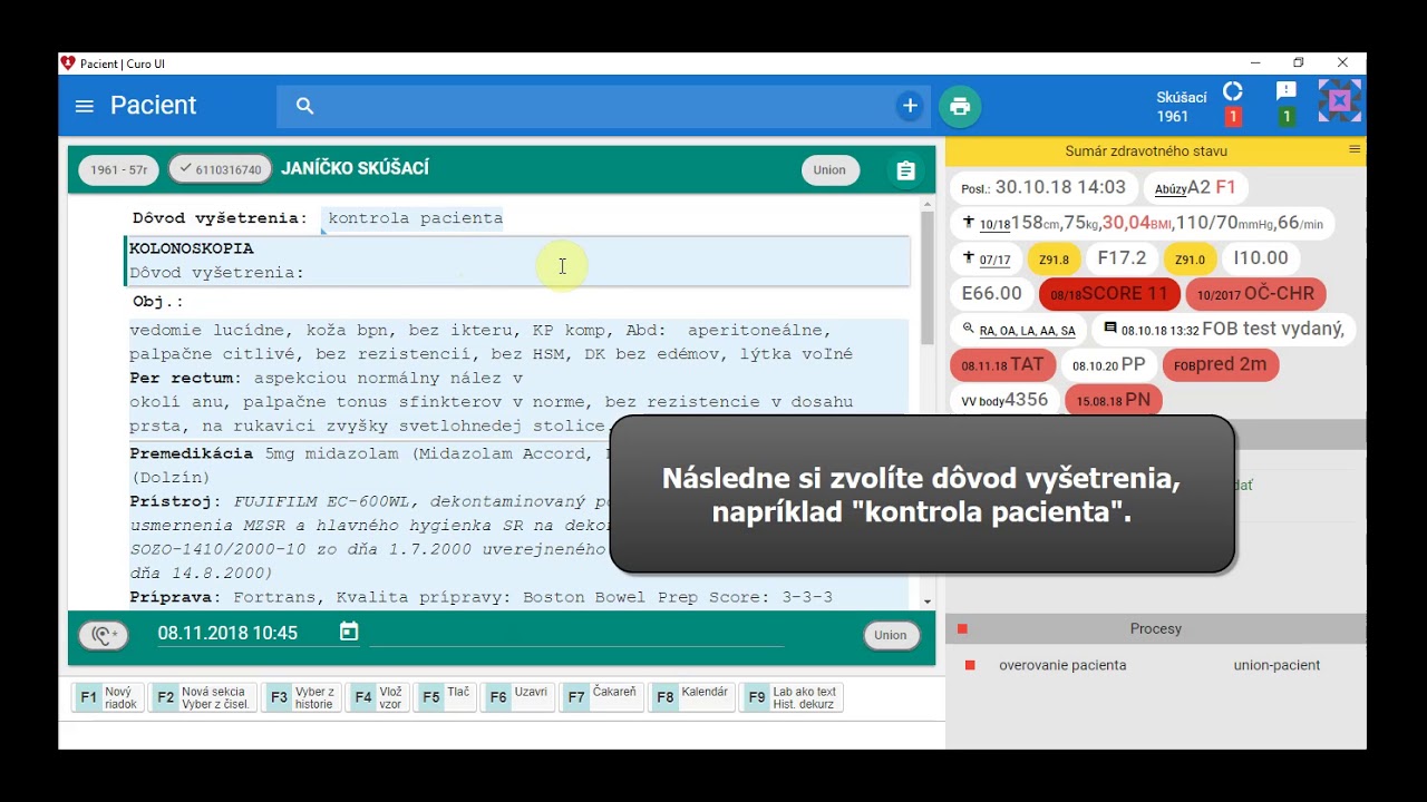 Náhľad videa Funkcionality CURO IS pre gastroenterológov