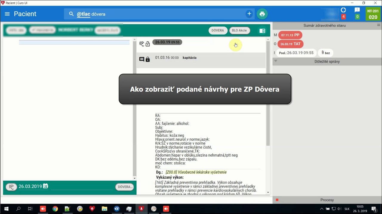 Náhľad videa Podané návrhy pre ZP Dôvera