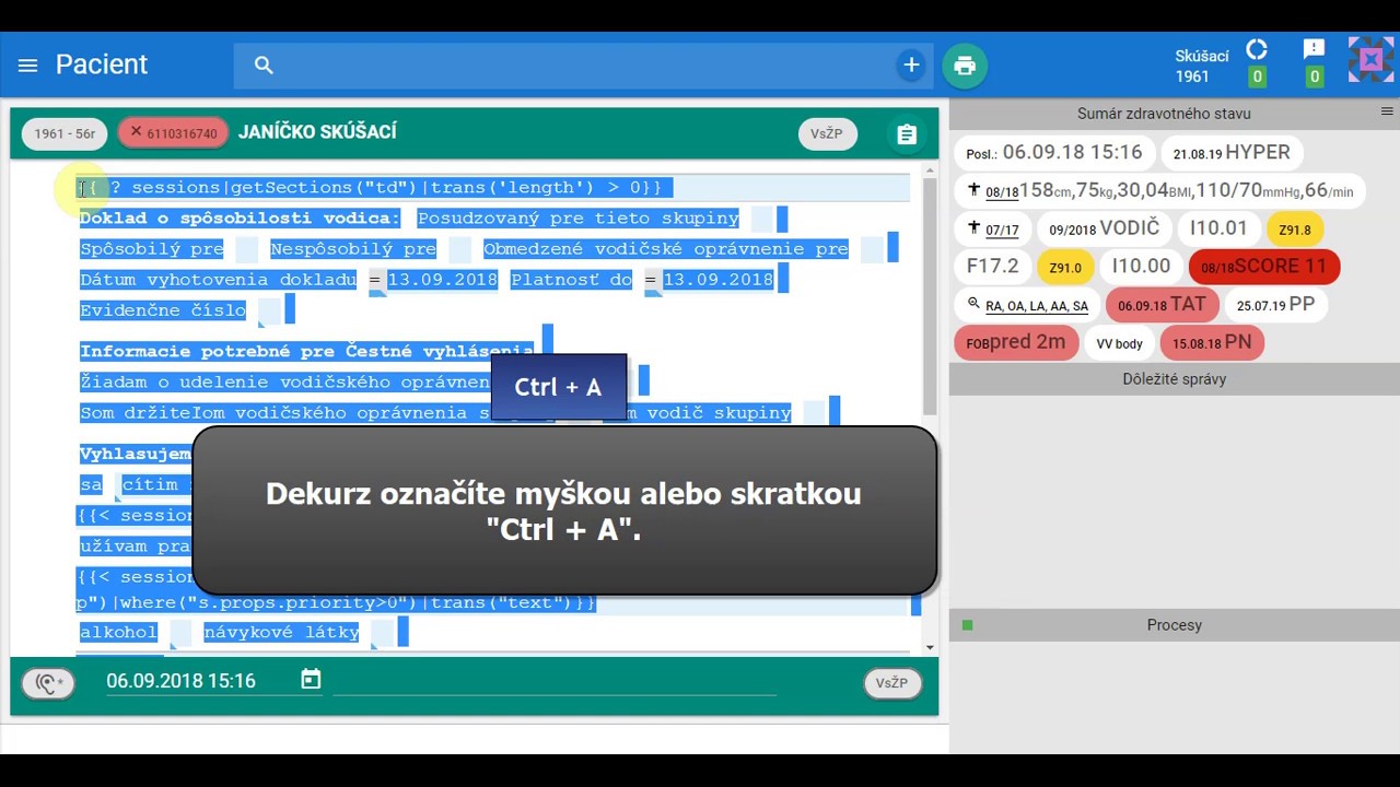 Náhľad videa Ako vytvoriť vzor z existujúceho dekurzu