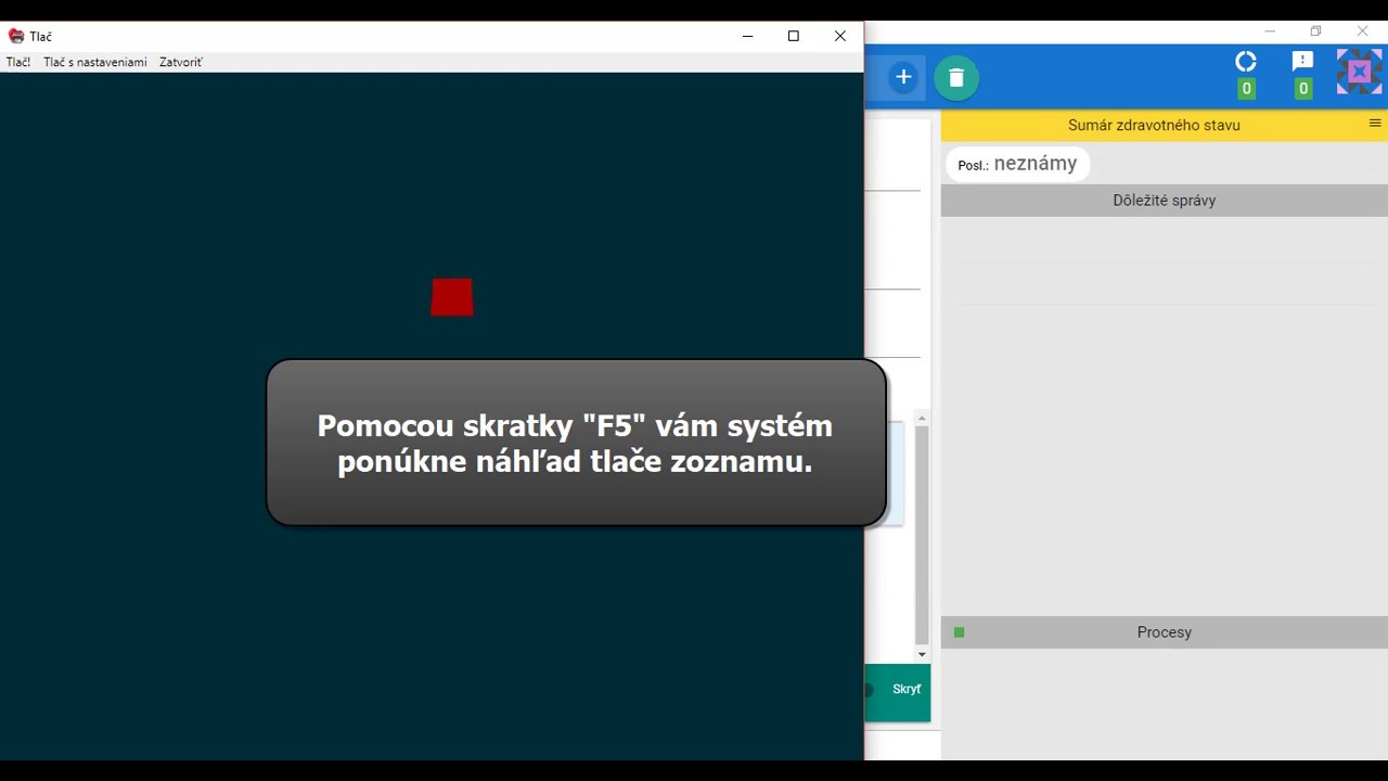 Náhľad videa Ako vytlačiť denný zoznam pacientov na podpis s textom informovaného súhlasu pacienta