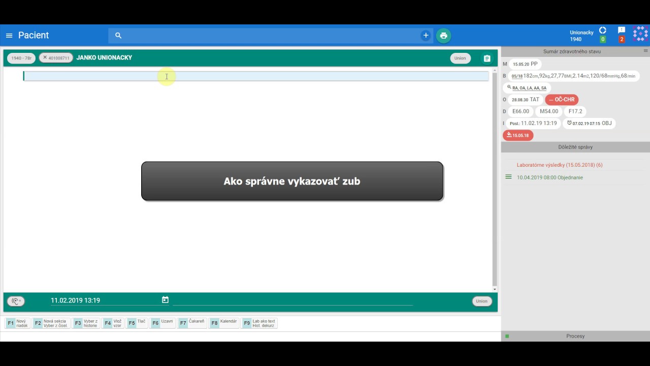 Náhľad videa Ako vykazovať zub