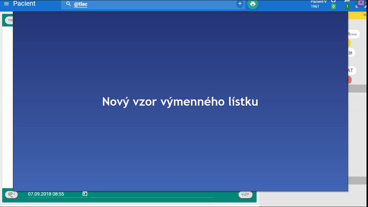 Náhľad videa Ako vložiť výmenný lístok